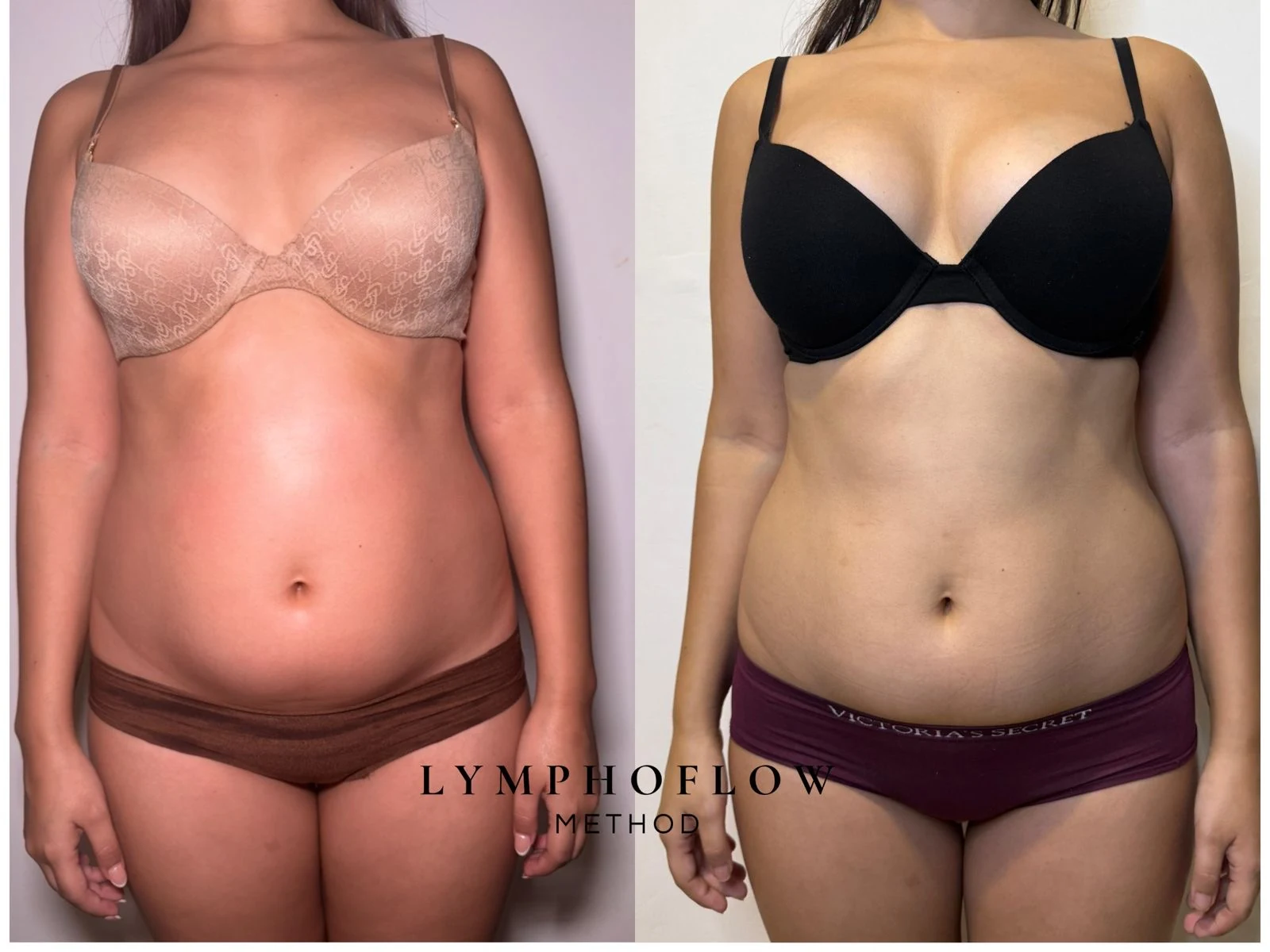 Antes y después de frente con bra beige y negro del protocolo Vientre Plano