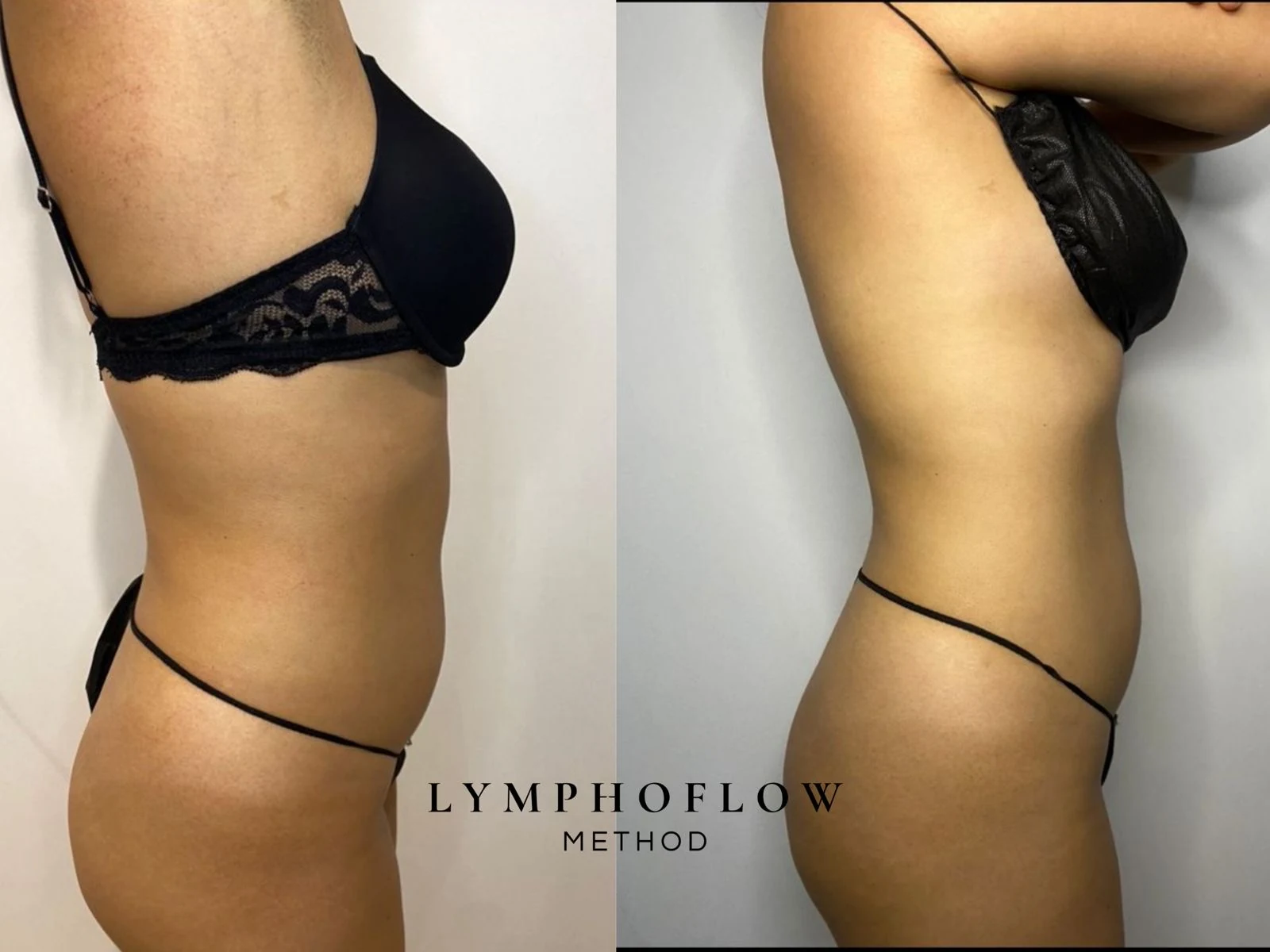 Antes y después lateral con bra negro del protocolo Vientre Plano